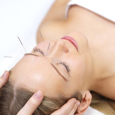 Acupuncture Norwich @ The Skin Lounge