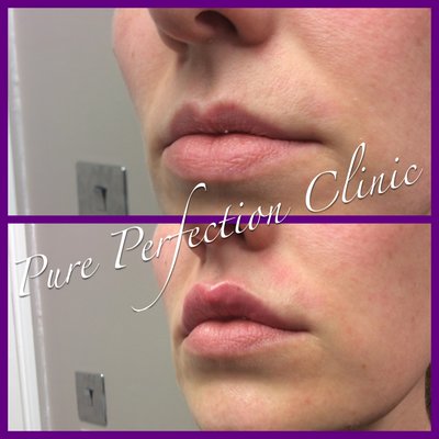 Pure Perfection Clinic
