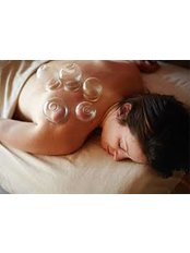 Cupping - Cork Acupuncture Clinic