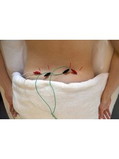 Electro-Acupuncture - Wholistic Wellness Chinese Acupuncture & Massage