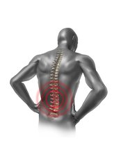 Back Pain Treatment - Dupuis Acupuncture