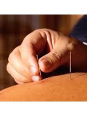Acupuncture Treatment - The Back Man Clinic