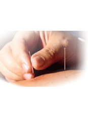 Acupuncture - Prime Meridian Acupuncture Clinic