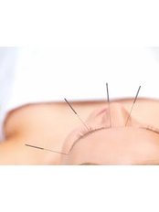 Acupuncturist Consultation - Point of Health