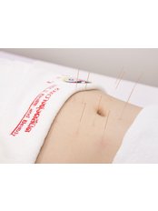 Weight Control Acupuncture - Suankwangtung Clinic