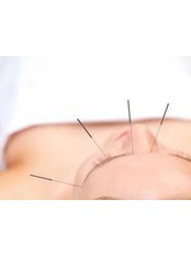 Cosmetic Acupuncture - Shaftesbury Clinic