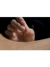 Acupuncture - Natural Harmony Acupuncture