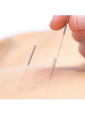 Acupuncturist Consultation - JHS Acupuncture