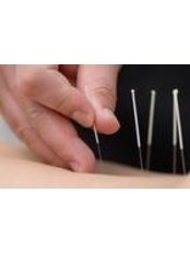 acupuncture - Chinese Doctor acupuncture and herbs