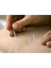Acupuncture Treatment (inc. 15mins massage) - Chiswick Chinese Medicine Clinic