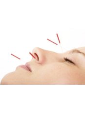 facial - Highgate Acupuncture Clinic