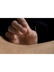 Electro-Acupuncture - Accu-Health