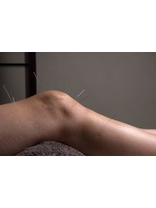 Knee Pain - St Helens Acupuncture