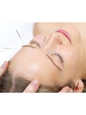 Non-Surgical Facelift - Acupuncture Norwich @ The Skin Lounge