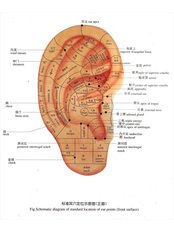 Auricular Acupuncture - The Chinese Medicine Sanctuary
