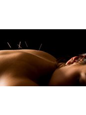 Acupuncturist Consultation - Sharon Kent Acupuncture