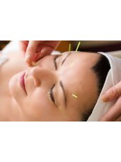 Acupuncture Facelift - Zen Rising Wellness Center