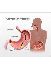 Gastroscopy - General Laparoscopic Surgeon