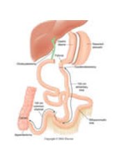 Duodenal Switch Procedure, Duodenal Switch Surgeon, Duodenal Switch Center, Duodenal Switch Surgery - Mexicali Bariatric Center