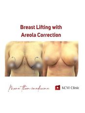 Breast Lift - KCM Clinic Jelenia Gora
