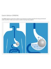 Gastric Balloon - INTER-MED