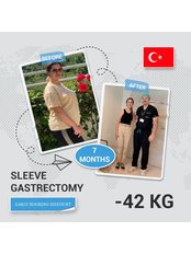 Gastric Sleeve - Assoc. Dr. Hasan Abuoğlu