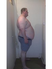 London Obesity Centre - Before gastric bypass 254kg 