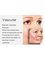 The Skin And Laser Clinic Sydney - Manage the visable appearance of Rosacea, cuperose and treat common vascular concerns; broken capillaries 