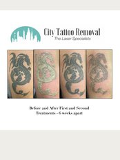 City Tattoo Removal - Suite 9 Renown Chambers, Level 1, 245 Albert Street, BRISBANE CITY, Qld, 4000, 