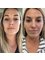 Harbour Medispa - Before and After Cosmetic Treatment 