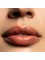 Melbourne Facials - Lips Enhancement 