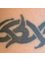 Lynn`s non-laser tattoo removal - 4/49  Church avenue, Armadale, wa, 6112,  10