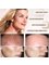 Horizon Vein and Cosmetic Centre - Melasma, Chloasma, Hyperpigmentation 