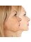 Spa Luxe Med Spa - Facial Filler Reshapes The Chin & Jawline 