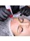 Spa Luxe Med Spa - Plasma Facial Combined With Microneedling For Best Skin Rejuvenation 
