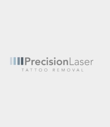 Precision Laser Tattoo Removal - London