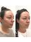 Skin Vitality Medical Clinic - London - Tear Trough Dermal Filler  