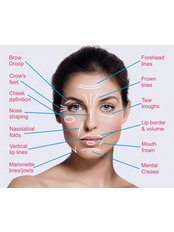 Treatment for wrinkles - Selin Laser MedSpa