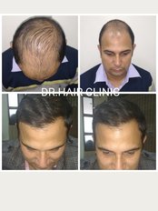 Dr. Hair Clinic - 50, JDA Market, Mansarovar Link Road, near riddhi siddhi circle, jaipur, rajasthan, 302018, 