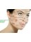 New Derma Aesthetic Clinic - Malad Branch - Skin laser traeatments 