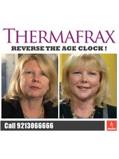 Thermage™ - Atelier Cosmetic Plastic and Laser Clinic-N Dehli