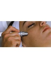 Megapeel Microdermabrasion: Face - Laserderm Clinic - Claregalway
