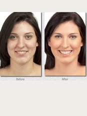 Chezelle Skin and Laser Clinic - lycogel 5