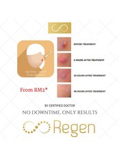 Acne Treatment - Regen Clinic