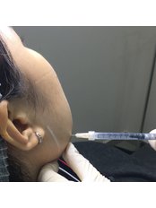 V-shape Face - NextMed Clinic Cheras