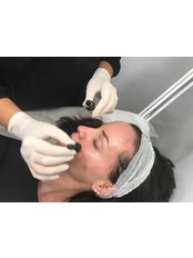 Deep Chemical Peel - People and Skin Med-Aesthetic Clinic