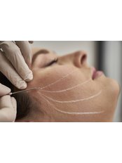 Thread Lifting - People and Skin Med-Aesthetic Clinic
