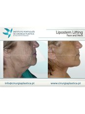 Neck Lift - UP HPA