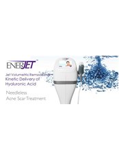Enerjet™ Needle-less Acne Scars Treatment - Vidaskin Medical and Aesthetics Clinic