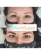Semi-Permanent Makeup - Classic Laser SA